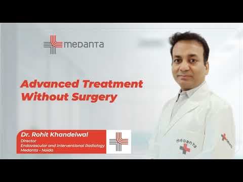 Advanced Treatment Without Surgery | Dr. Rohit Khandelwal | Medanta Noida
